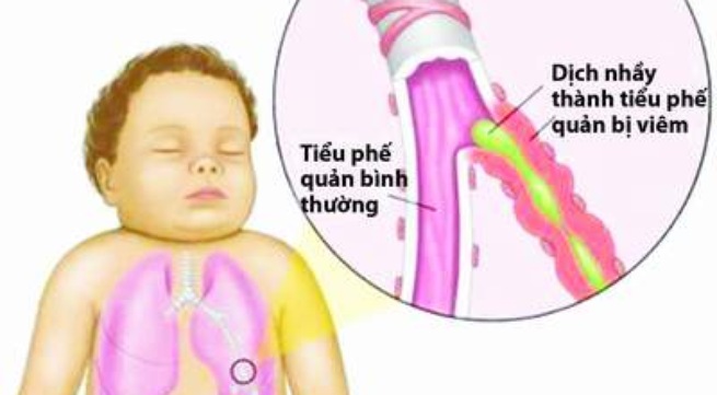 Tuyển sinh Đại học trực tuyến