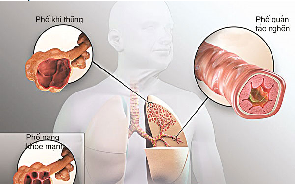 Tuyển sinh Đại học trực tuyến