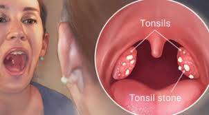 Tuyển sinh Đại học trực tuyến